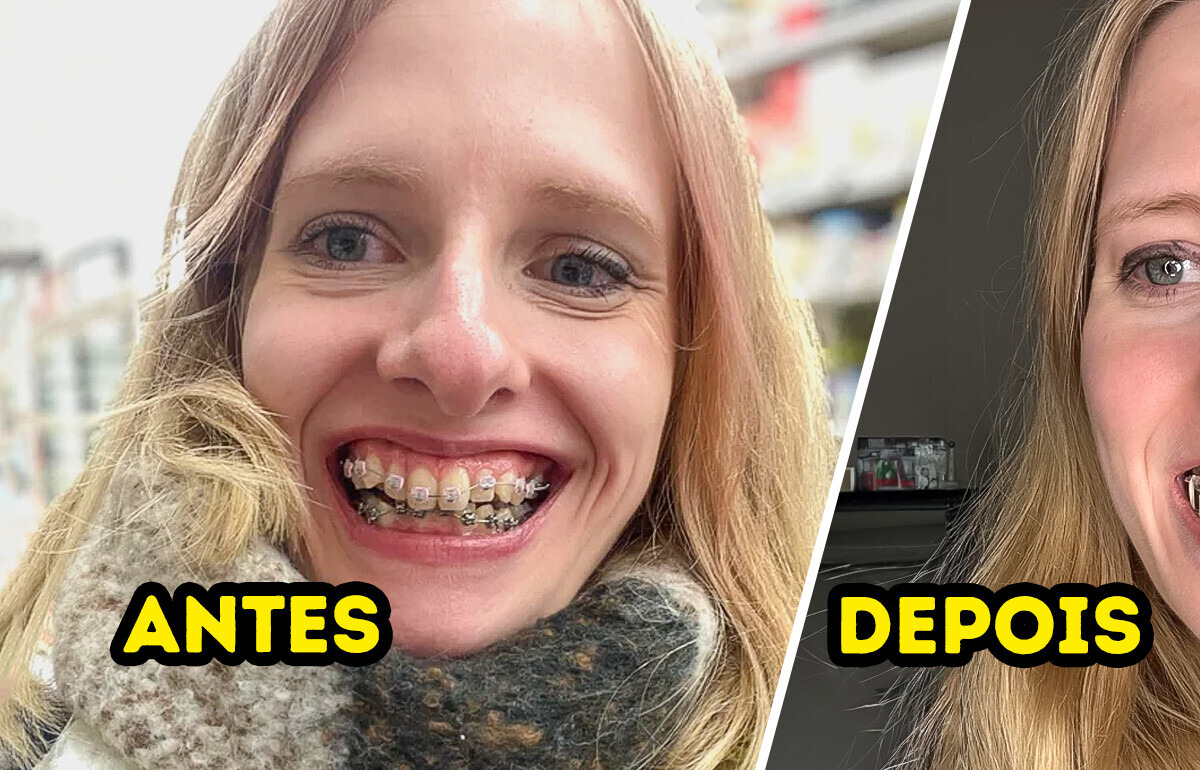 15 Sorrisos que viraram cartões de visita para uma nova vida