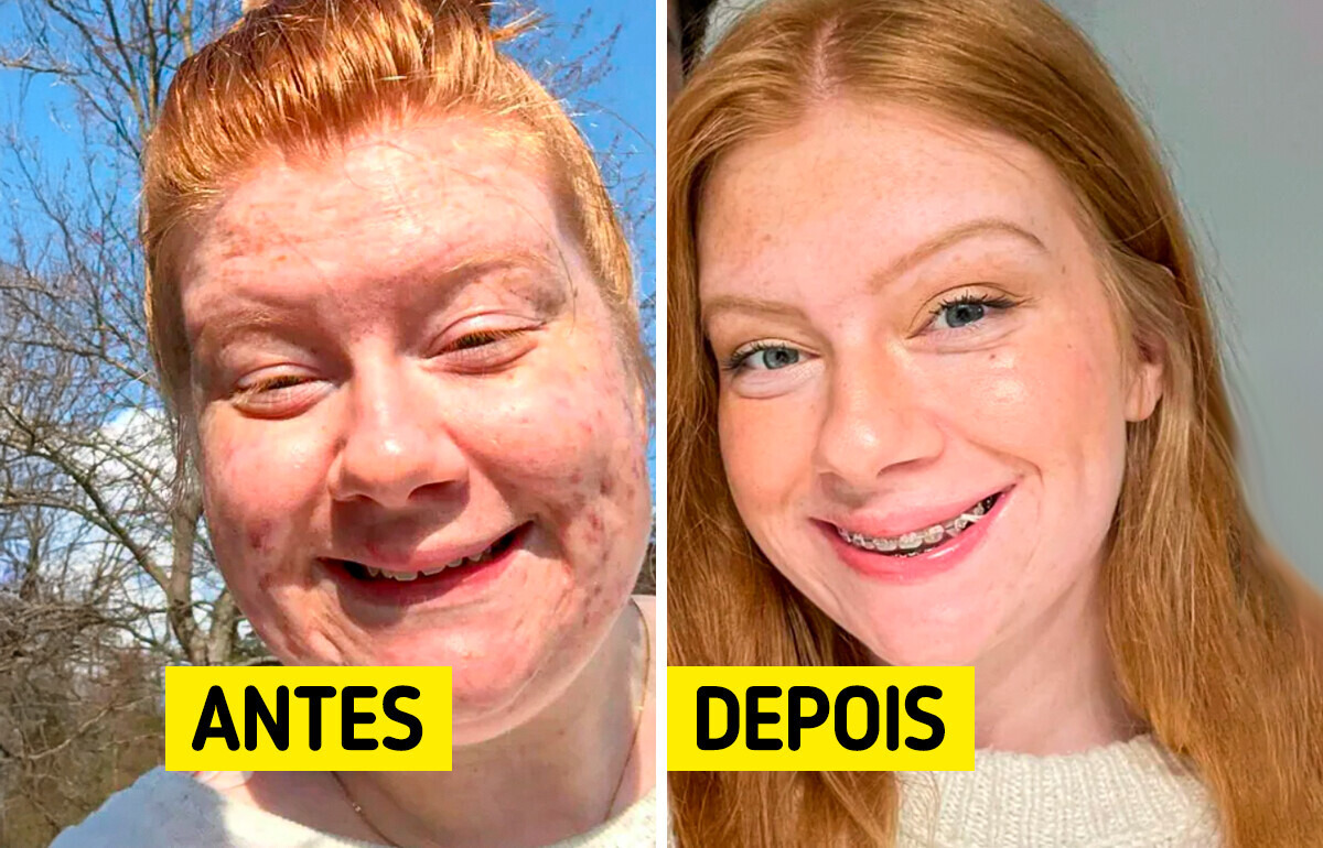 16 Pessoas que esbanjaram orgulho ao mostrar como mudaram ao longo dos anos