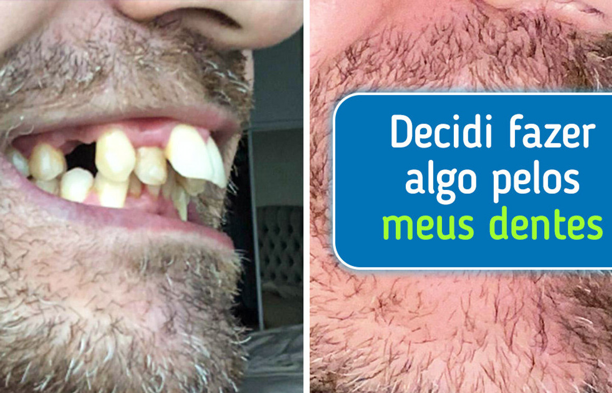 15 Pessoas que mudaram de visual e o resultado é de cair o queixo