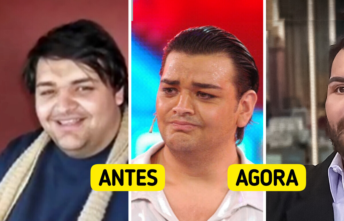 Obcecado por Ricky Martin, homem transforma o rosto com dezenas de cirurgias