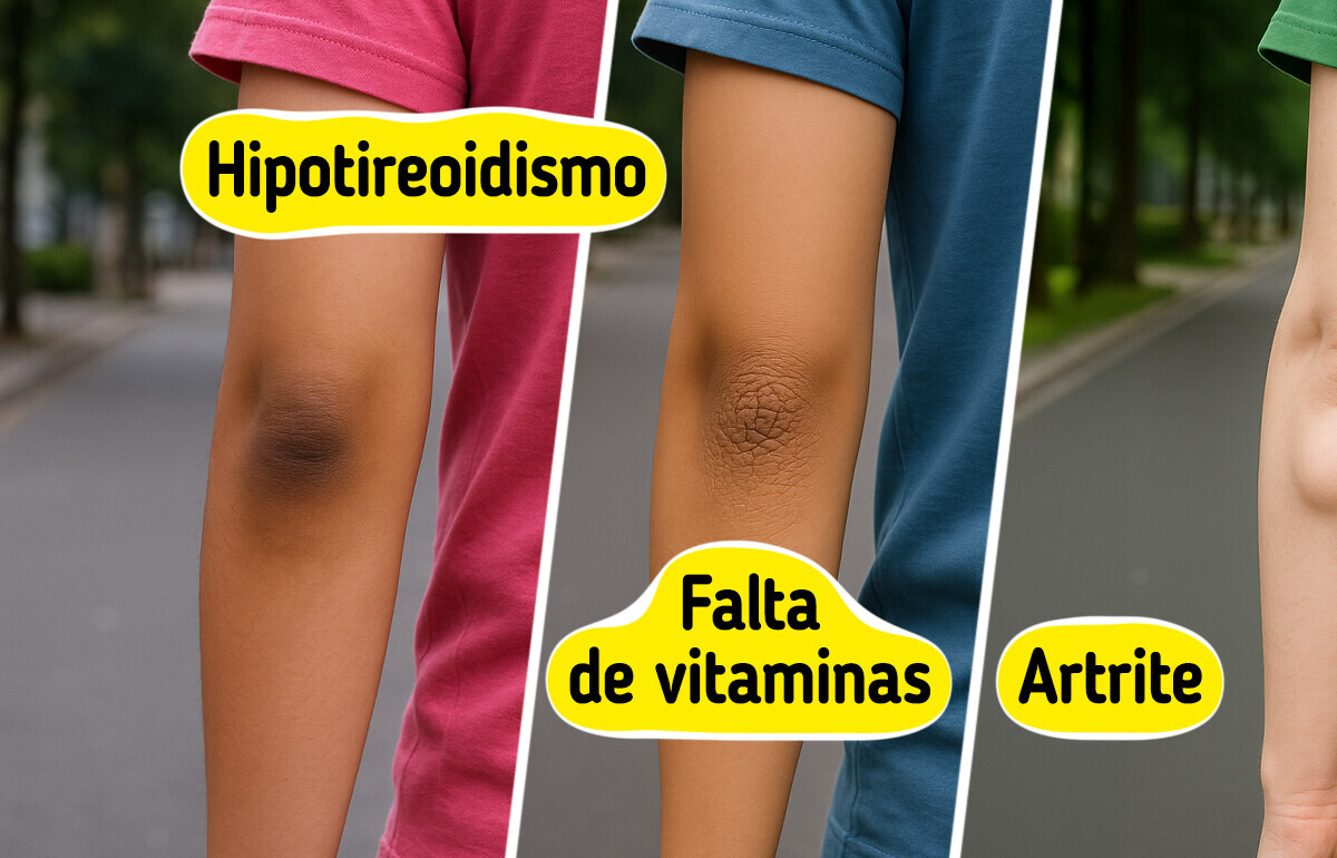 10 Sintomas que seu cotovelo está tentando te contar sobre o seu corpo 10 Sintomas que seu cotovelo está tentando te contar sobre o seu corpo