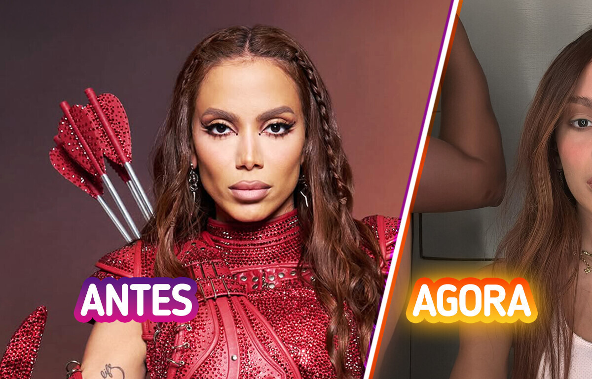 “Nossa Michael Jackson”, Anitta surge com novo rosto e gera polêmica nas redes