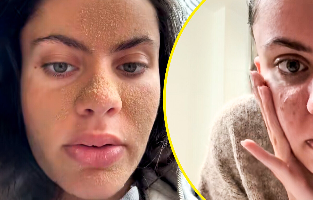 Mulher resolveu passar semanas sem lavar o rosto e resultado foi controverso Mulher resolveu passar semanas sem lavar o rosto e resultado foi controverso