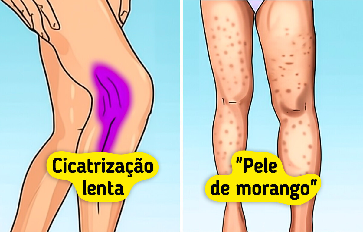 7 Jeitos nem sempre discretos de o seu corpo pedir por mais colágeno
