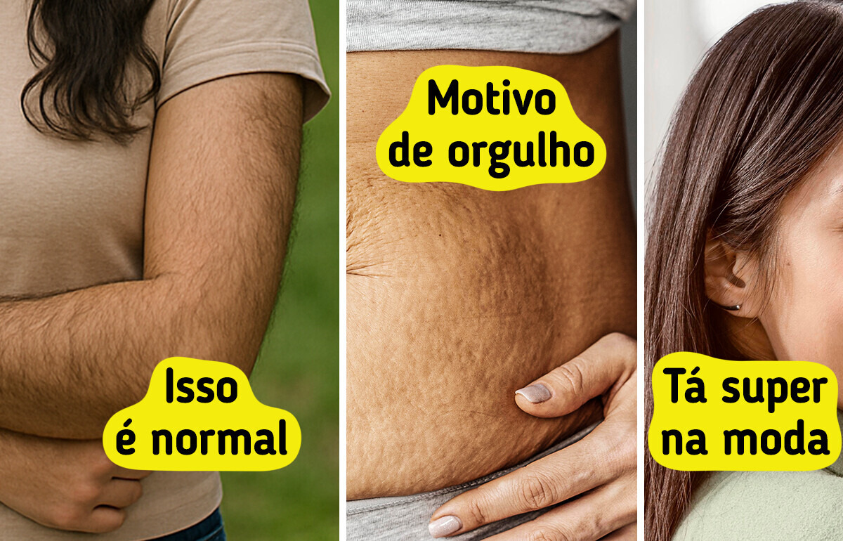 11 Traços que fazem parte da beleza feminina e não precisam ser corrigidos