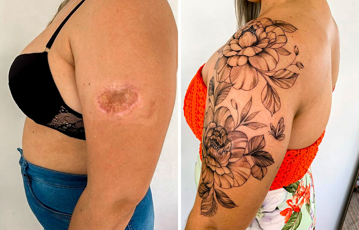 Cicatriz vira traço e dor se torna manifesto nas mãos de uma tatuadora brasileira