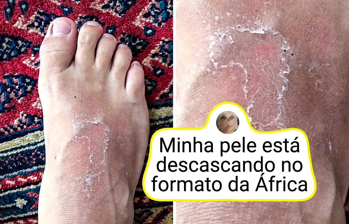 7 Traços corporais raros que tornam algumas pessoas únicas