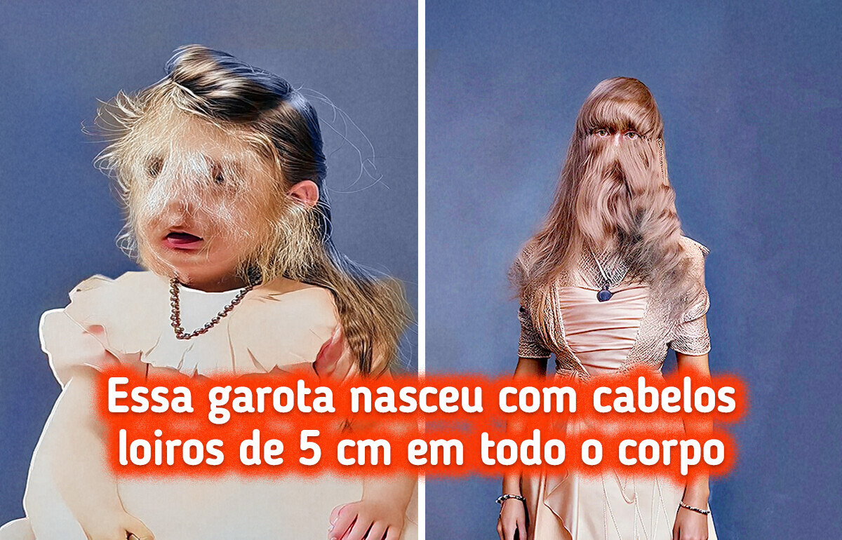 15 Pessoas que nasceram com traços exclusivos dados pela Mãe Natureza 15 Pessoas que nasceram com traços exclusivos dados pela Mãe Natureza