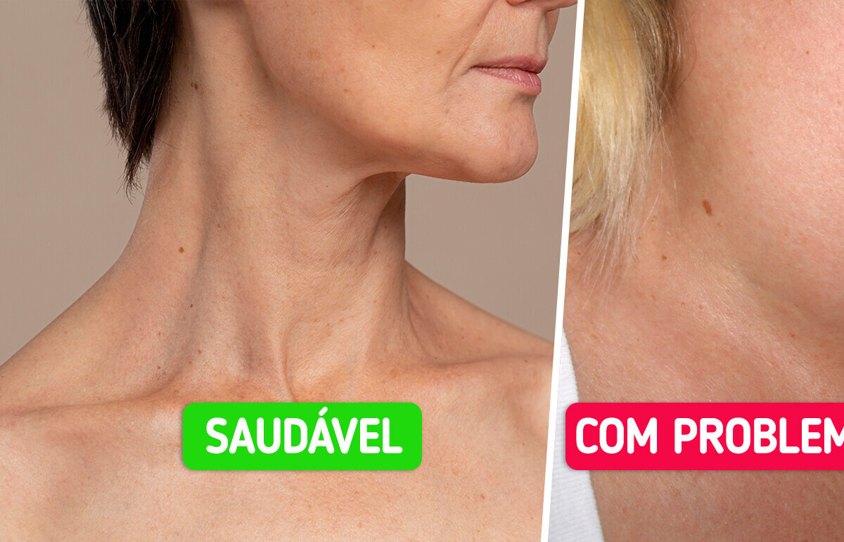 6 Sintomas de problemas na tireoide que você não pode fingir que não viu