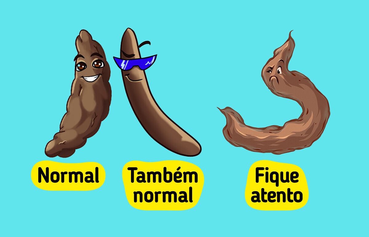 5 Sintomas de câncer de intestino que muita gente ignora achando que é má digestão