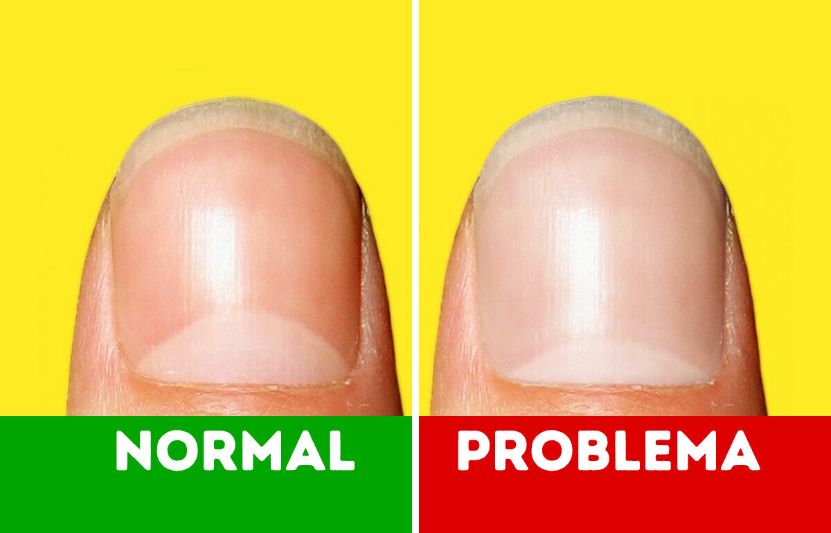 Unhas brancas e outros 9 indícios de que seu corpo está pedindo socorro Unhas brancas e outros 9 indícios de que seu corpo está pedindo socorro