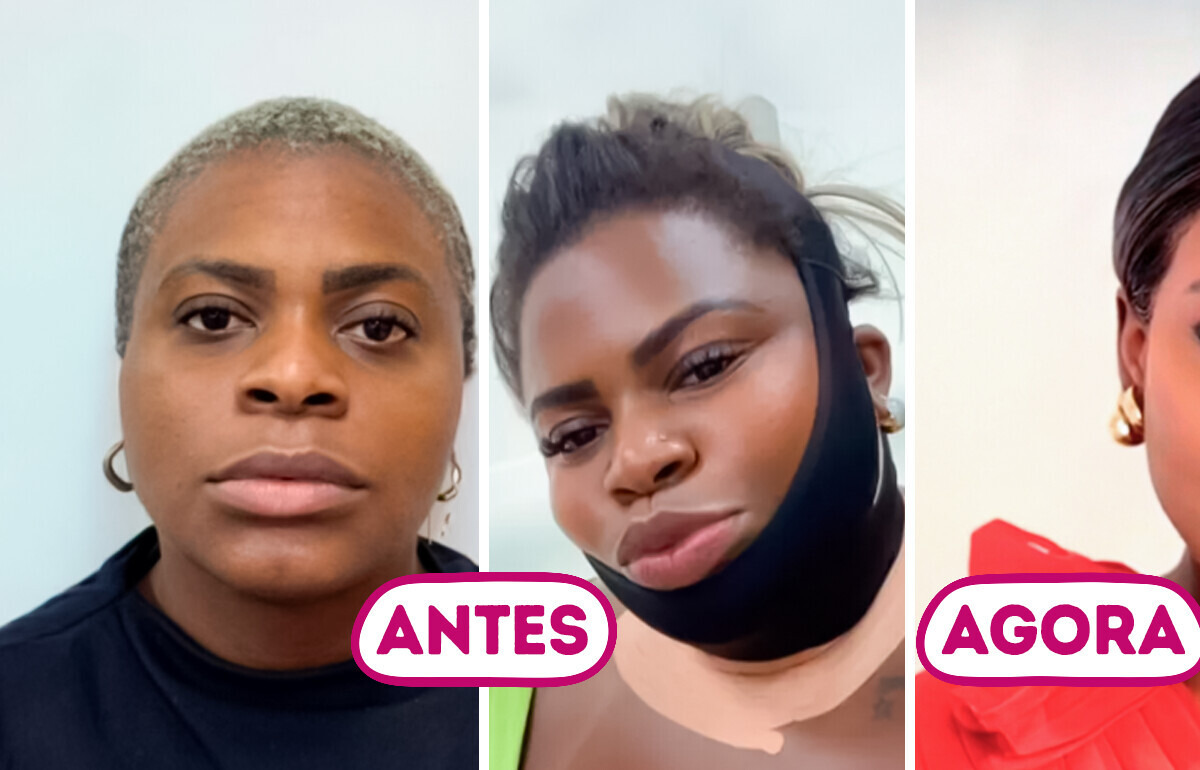 Transformação no rosto de Jojo Todynho gera debate nas redes sociais