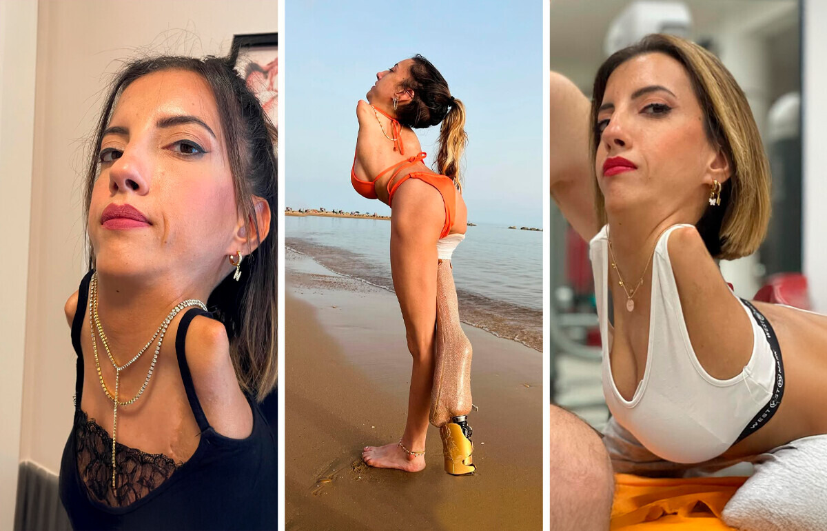 Sem braços e uma perna, mulher desafia limites e transforma vidas com seu exemplo Sem braços e uma perna, mulher desafia limites e transforma vidas com seu exemplo