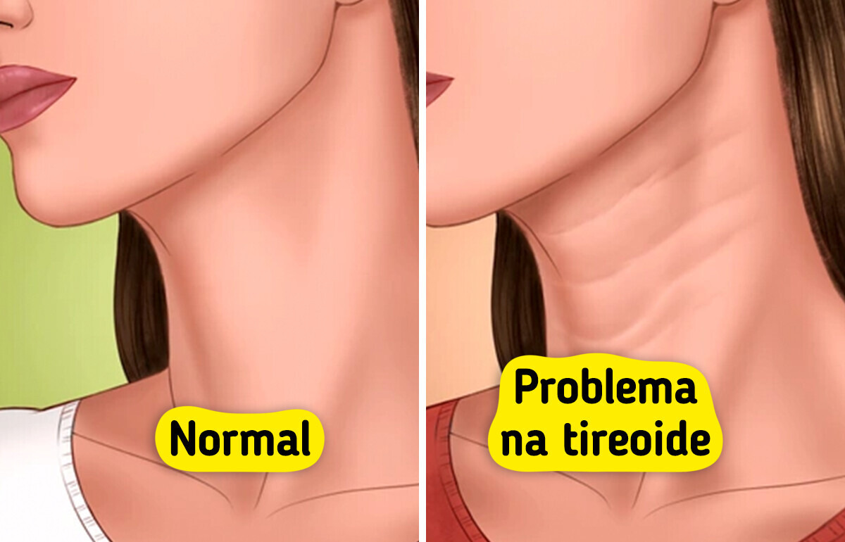 7 Sinais sutis que seu corpo usa para pedir ajuda