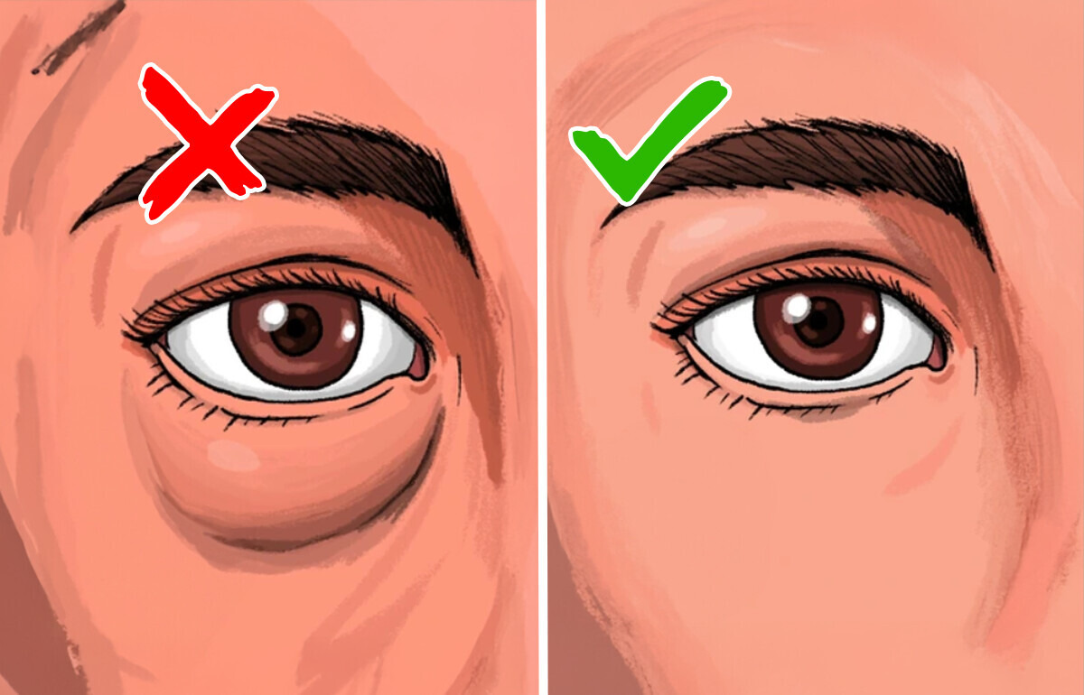 9 Sinais sutis de que seus rins podem estar pedindo socorro 9 Sinais sutis de que seus rins podem estar pedindo socorro