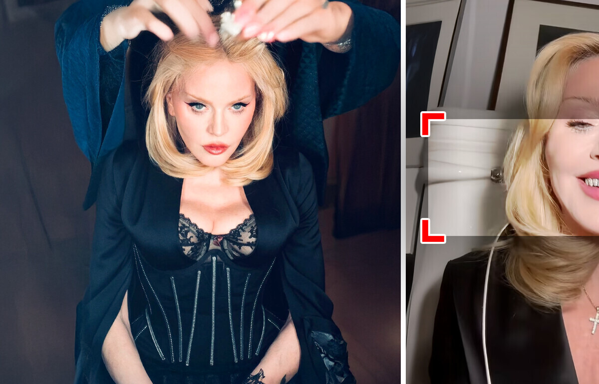 Madonna mostrou os novos dentes e a maioria reparou na mesma coisa