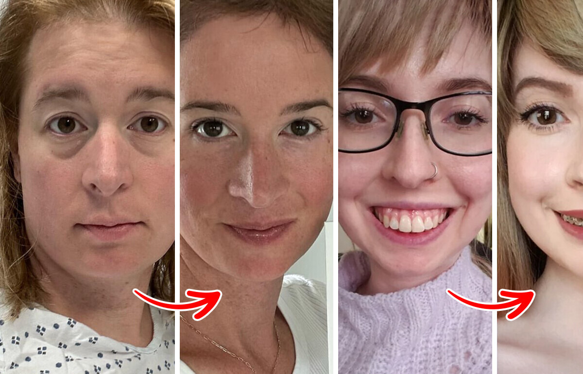 16 Mulheres que provam que até a menor das mudanças pode ser poderosa