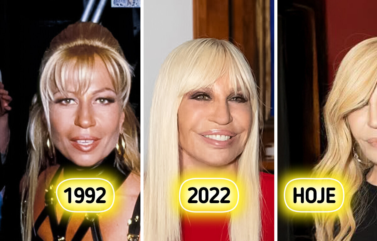 Criticada pelos exageros, Donatella Versace ressurge com outro rejuvenescimento que ninguém esperava Criticada pelos exageros, Donatella Versace ressurge com outro rejuvenescimento que ninguém esperava