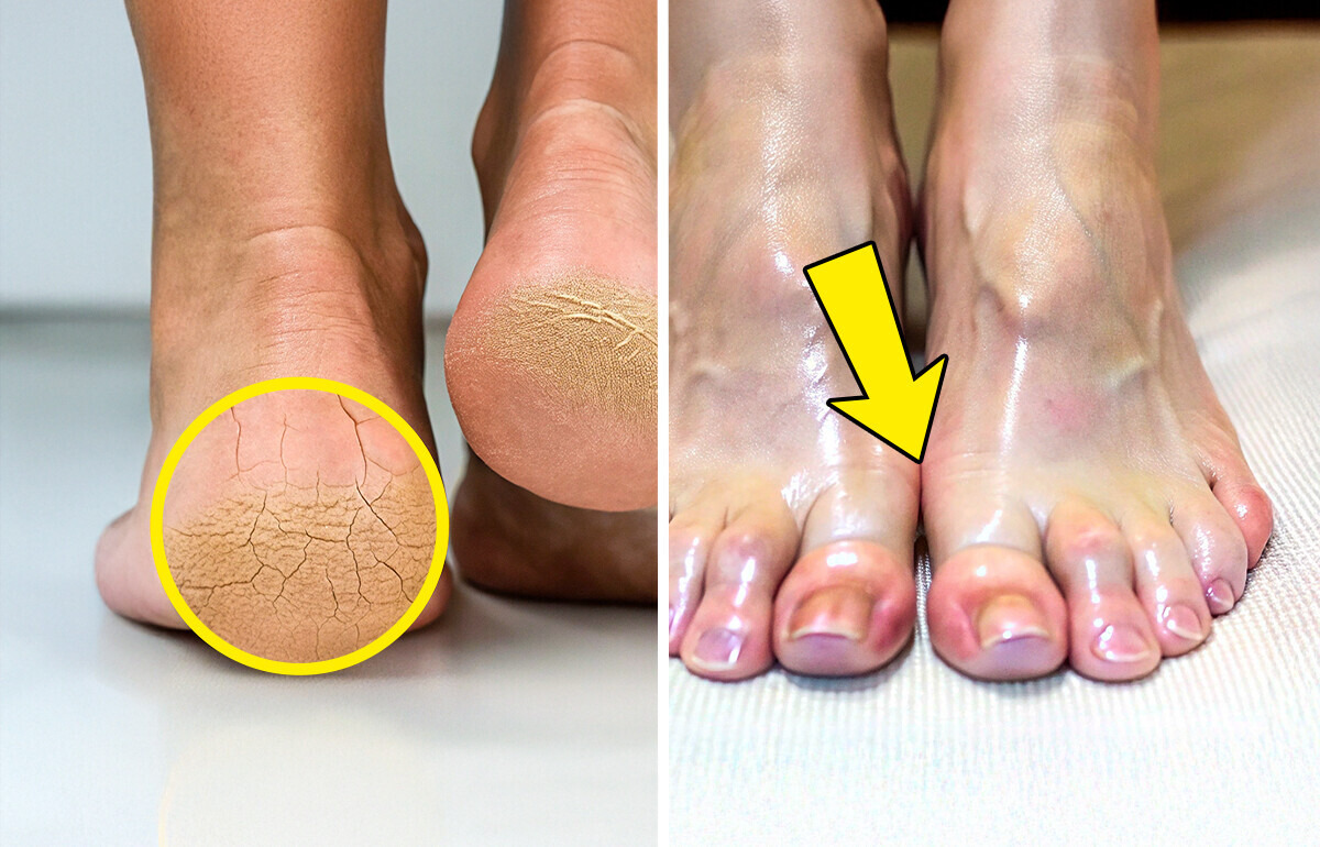 7 Cuidados de beleza para os pés que talvez você nunca tenha pensado em experimentar 7 Cuidados de beleza para os pés que talvez você nunca tenha pensado em experimentar
