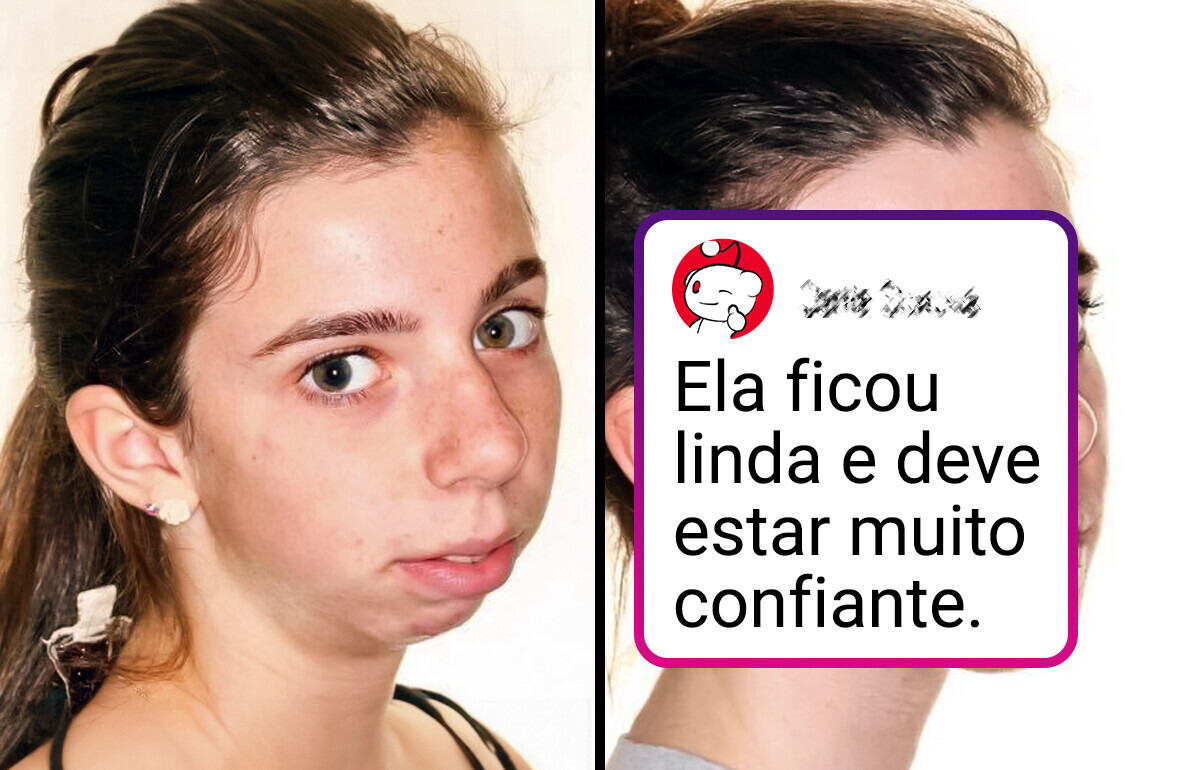20 Pessoas que ajustaram um detalhe e viraram protagonistas da própria beleza