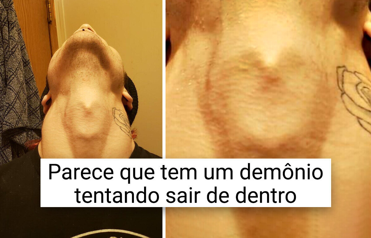 17 Pessoas cujos corpos guardam tesouros incríveis