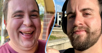 20+ Fotos de antes e depois que provam a força de uma pessoa determinada