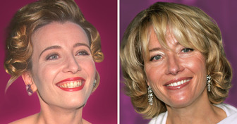 19 Celebridades que mudaram os dentes e deram novo brilho ao sorriso