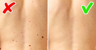 8 Doenças sérias cujos sinais aparecem em nossa pele