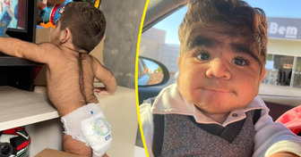 Bebê brasileiro peludinho chama atenção e viraliza: ‘Parece ter 35 anos!’