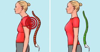 8 Exercícios simples para melhorar a postura e reduzir a dor nas costas