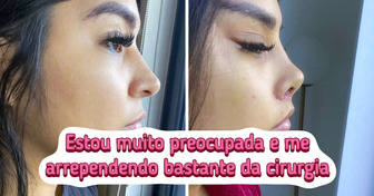 16 Pessoas que apostaram em procedimentos estéticos e se decepcionaram com o resultado