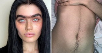 Estas 15 mulheres provam que pelos no corpo não são motivo para vergonha