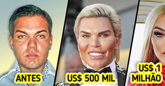 Gastei US$ 1 milhão em cirurgias plásticas para me parecer com a Barbie