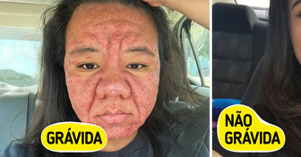 Mulher de 28 anos revela como a gravidez mudou drasticamente seu rosto
