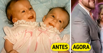 União inusitada: casamento de gêmea siamesa vira foco nas redes sociais