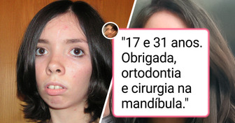 18 Cirurgias plásticas que foram além da estética e transformaram vidas