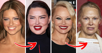 10 Celebridades que mudaram drasticamente a própria aparência