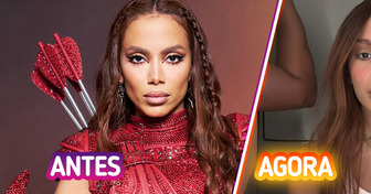 “Nossa Michael Jackson”, Anitta surge com novo rosto e gera polêmica nas redes