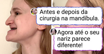 15+ Pessoas que mudaram um detalhezinho e fizeram a internet perguntar: 'O que aconteceu com você?