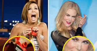 10 Celebridades que mantiveram a pose mesmo quando tudo saiu do controle