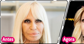 “Esse médico merece o prêmio Nobel!” Novo visual de Donatella Versace causa alvoroço na Internet