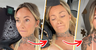 Ela tatuou a marca do biquíni no corpo, mas o motivo não é só vaidade