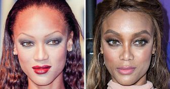 17 Fotos de antes e depois de celebridades que mostram como a sobrancelha pode mudar um rosto