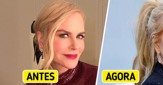 Nicole Kidman surge com detalhe no rosto que intrigou fãs
