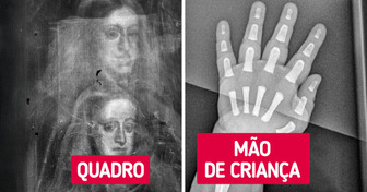 20+ Radiografias que revelam detalhes do mundo invisíveis a olho nu