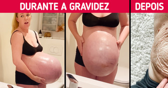 Barriga gigante de grávida de trigêmeos faz a web perguntar: "Isso é real?"