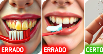 Dentista revela 2 erros de escovação que podem deixar seus dentes amarelados