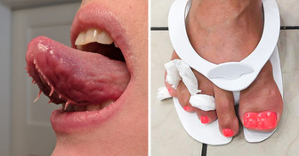 19 Pessoas que transformaram o que chamavam de defeito em charme único