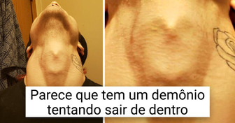17 Pessoas cujos corpos guardam tesouros incríveis
