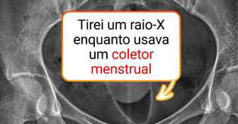 15 Imagens reais que bagunçaram a cabeça de quem viu